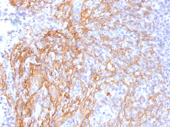 IHC-P analysis of human tonsil tissue using GTX34441 beta Catenin antibody [6F9].