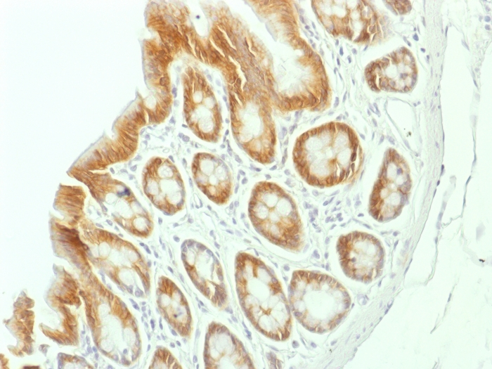 IHC-P analysis of rat colon tissue using GTX34442 beta Catenin antibody [CTNNB1/1507].