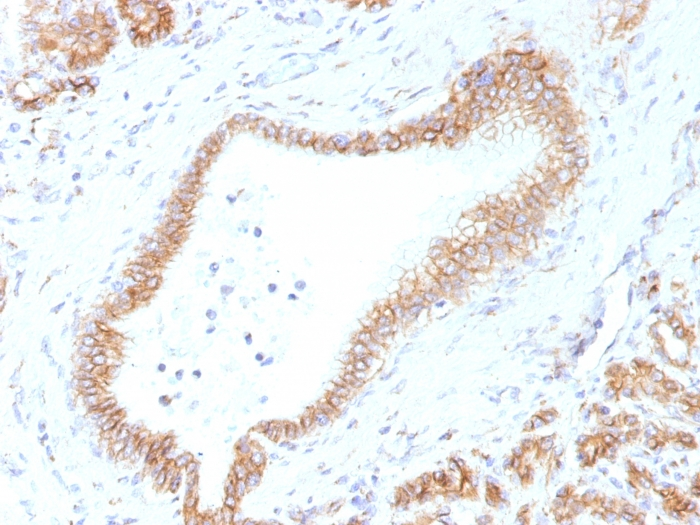 IHC-P analysis of human pancreas tissue using GTX34442 beta Catenin antibody [CTNNB1/1507].