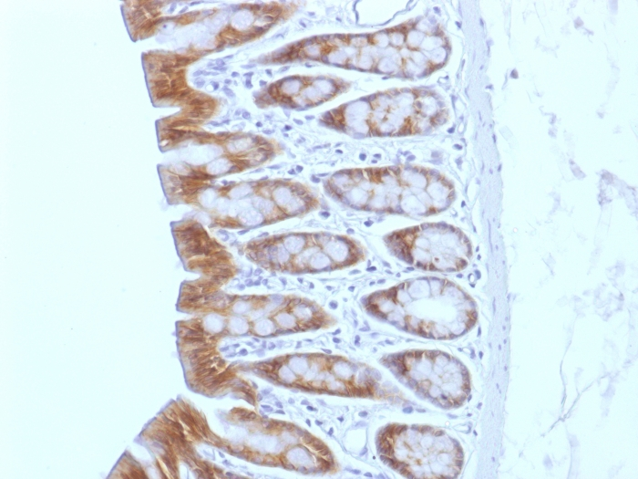 IHC-P analysis of rat colon tissue using GTX34443 beta Catenin antibody [CTNNB1/1508].