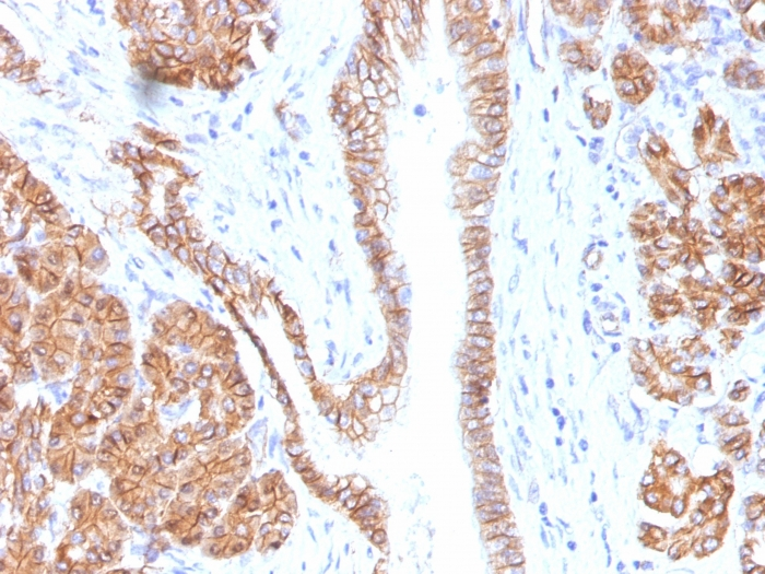 IHC-P analysis of human pancreas tissue using GTX34443 beta Catenin antibody [CTNNB1/1508].
