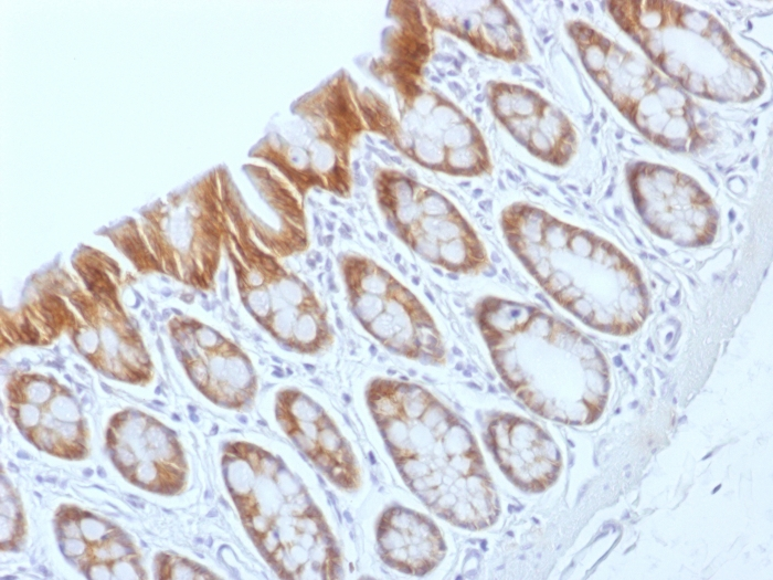 IHC-P analysis of rat colon tissue using GTX34444 beta Catenin antibody [CTNNB1/1509].