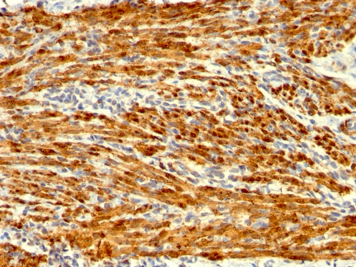 IHC-P analysis of human uterus tissue using GTX34447 Calponin 1 antibody [SPM169].