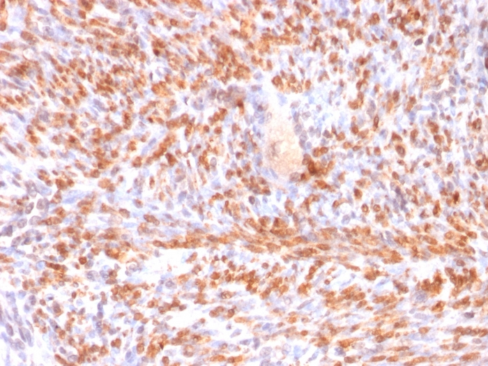 IHC-P analysis of human uterus tissue using GTX34449 Calponin 1 antibody [rCNN1/832].