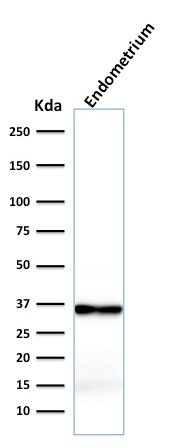 WB analysis of endometrium lysate using GTX34449 Calponin 1 antibody [rCNN1/832].
