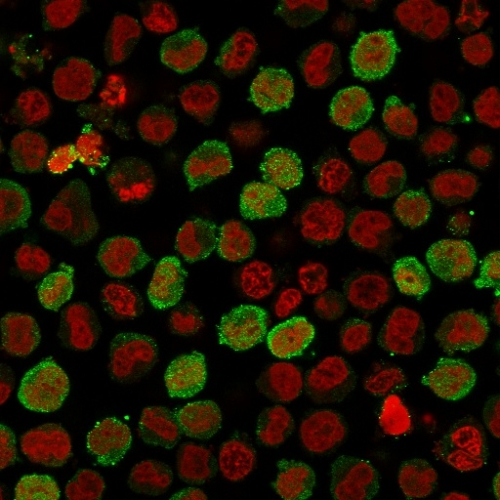 ICC/IF analysis of K562 cells using GTX34450 Calponin 1 antibody [CNN1/1408R]. Green : Primary antibody Red : nucleus