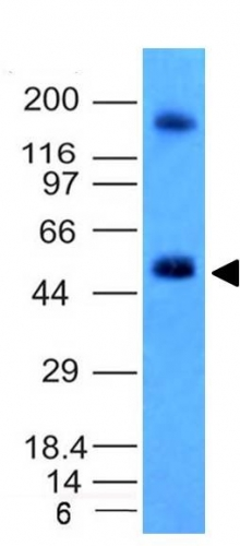 WB analysis of HCT116 cell lysate using GTX34452 Carbonic Anhydrase IX antibody [CA9/781].