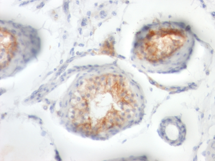 IHC-P analysis of human testicular carcinoma tissue using GTX34463 CD147 antibody [BSG/963].