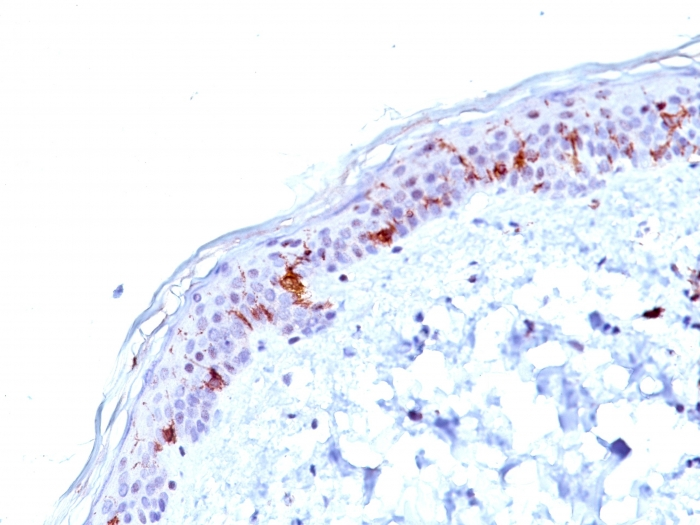 IHC-P analysis of human skin tissue using GTX34469 CD1a antibody [O10].