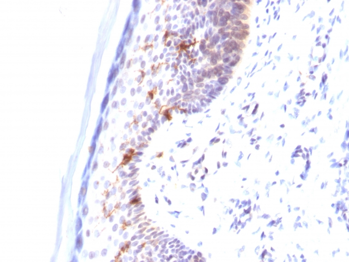 IHC-P analysis of human skin tissue using GTX34471 CD1a antibody [C1A/711].