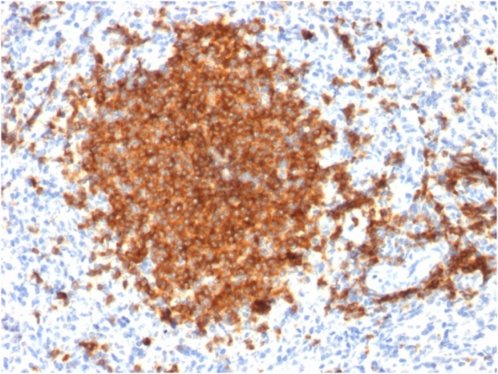 IHC-P analysis of human spleen tissue using GTX34478 CD22 antibody [BLCAM/1795].