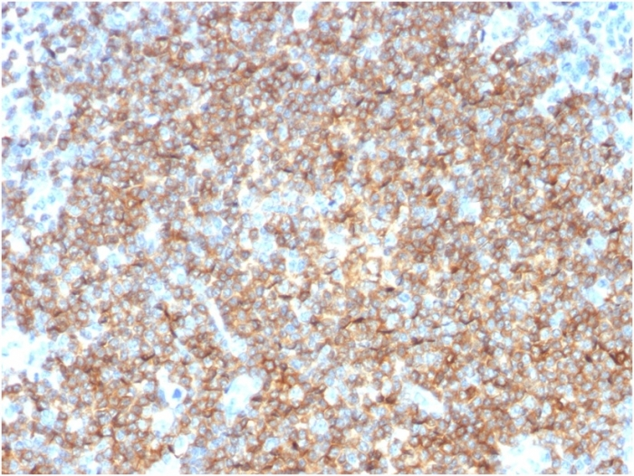IHC-P analysis of human tonsil tissue using GTX34478 CD22 antibody [BLCAM/1795].