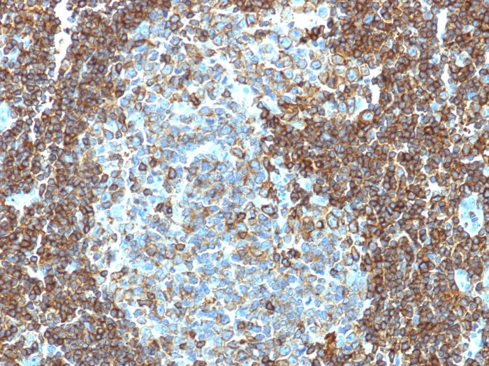 Formalin-fixed,paraffin-embedded human Tonsil stained with CD3 epsilon Monoclonal Antibody (PC3/188A).