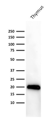 WB analysis of human thymus tissue lysate using GTX34480 CD3 epsilon antibody [PC3/188A].
