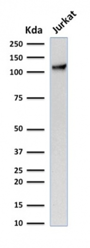 WB analysis of Jurkat cell lysate using GTX34489 CD31 antibody [C31.7].