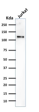WB analysis of Jurkat cell lysate using GTX34491 CD31 antibody [SPM532].