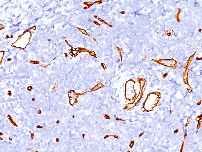Formalin-fixed,paraffin-embedded human Tonsil stained with CD34 Monoclonal Antibody (SPM123)