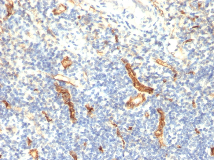 IHC-P analysis of human tonsil tissue using GTX34500 CD34 antibody [HPCA1/1171].