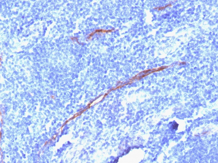 IHC-P analysis of human tonsil tissue using GTX34502 CD34 antibody [HPCA1/1806R].