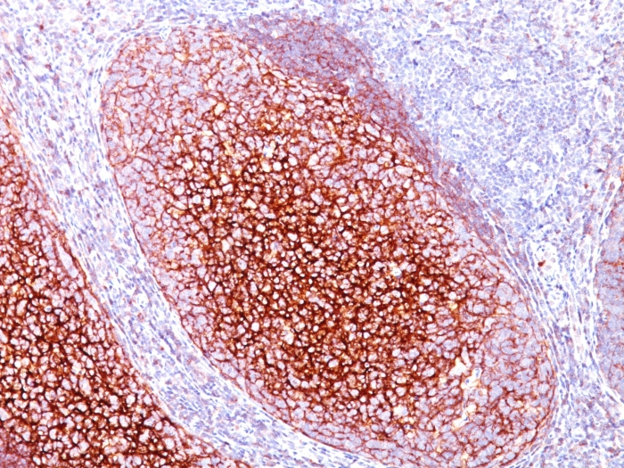 Formalin-fixed,paraffin-embedded human Tonsil stained with CD35 Monoclonal Antibody (CR1/802).