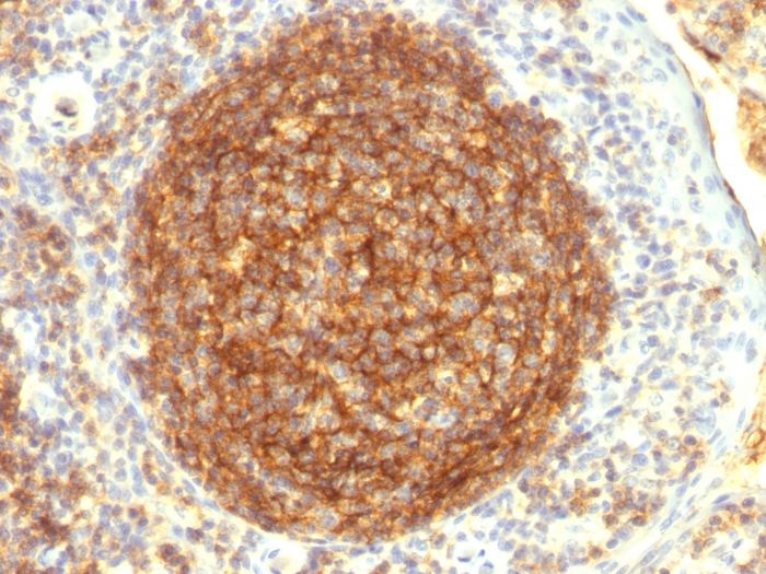 IHC-P analysis of human tonsil tissue using GTX34504 CD35 antibody [CR1/802].