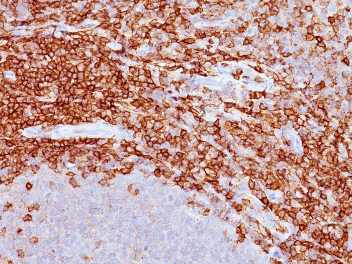 IHC-P analysis of human spleen tissue using GTX34507 CD43 antibody [SPM503].