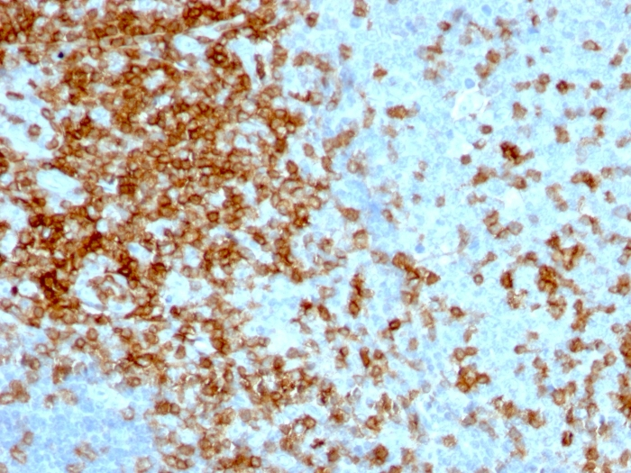 IHC-P analysis of human tonsil tissue using GTX34509 CD43 antibody [84-3C1].