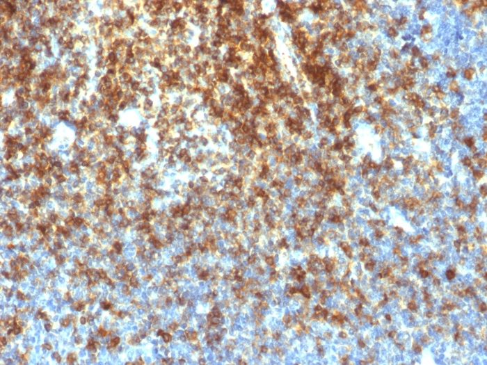 IHC-P analysis of human tonsil tissue using GTX34512 CD43 antibody [SPN/1766R].