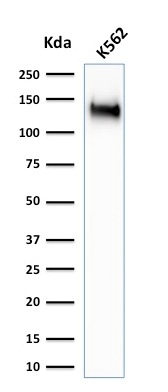 WB analysis of K562 cell lysate using GTX34512 CD43 antibody [SPN/1766R].