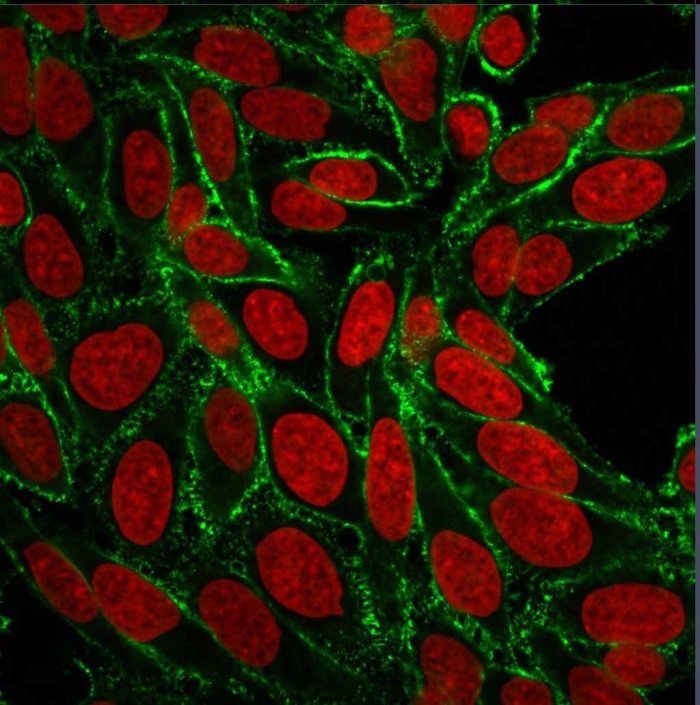 Formalin-fixed,paraffin-embedded human Breast Carcinoma stained with CD44 Monoclonal Antibody (156-3C11)