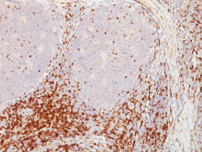Formalin-fixed,paraffin-embedded human Tonsil stained with CD5 Monoclonal Antibody (CD5/54/F6)