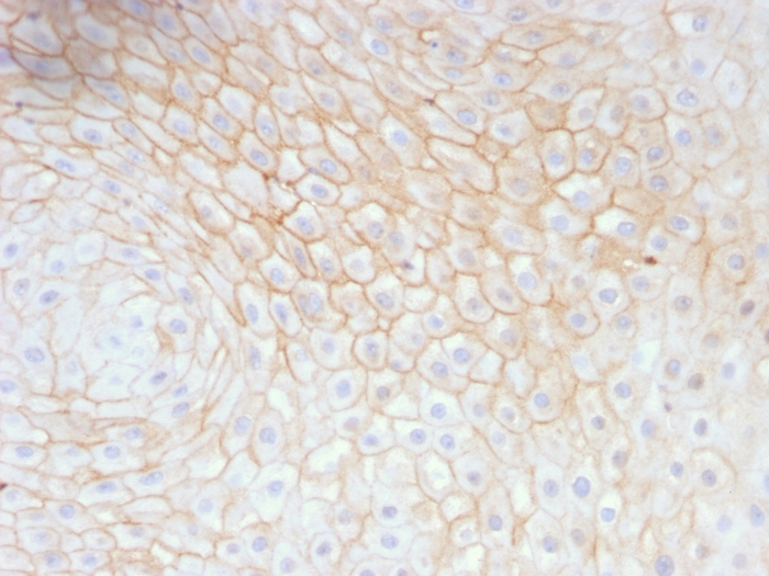 IHC-P analysis of human tongue tissue using GTX34532 CD59 antibody [MACIF/629].