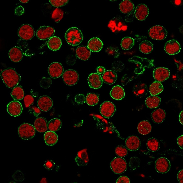 ICC/IF analysis of MOLT-4 cells using GTX34535 CD6 antibody [3F7B5]. Green : Primary antibody Red : nucleus