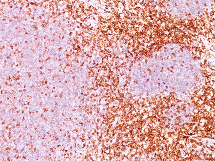 IHC-P analysis of human tonsil tissue using GTX34535 CD6 antibody [3F7B5].