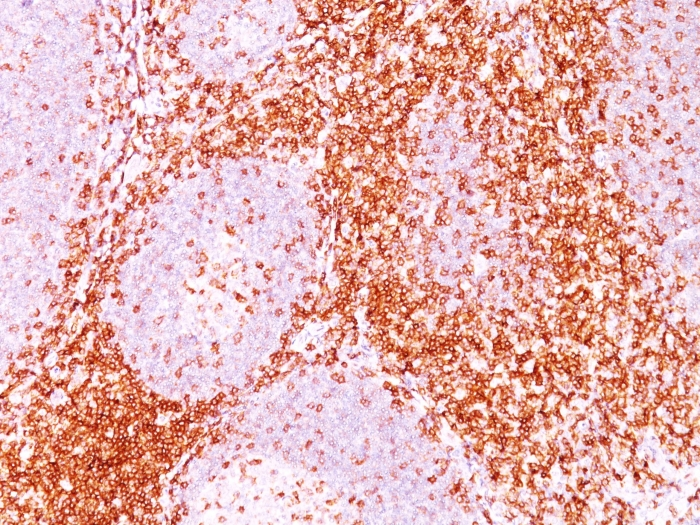 IHC-P analysis of human tonsil tissue using GTX34535 CD6 antibody [3F7B5].