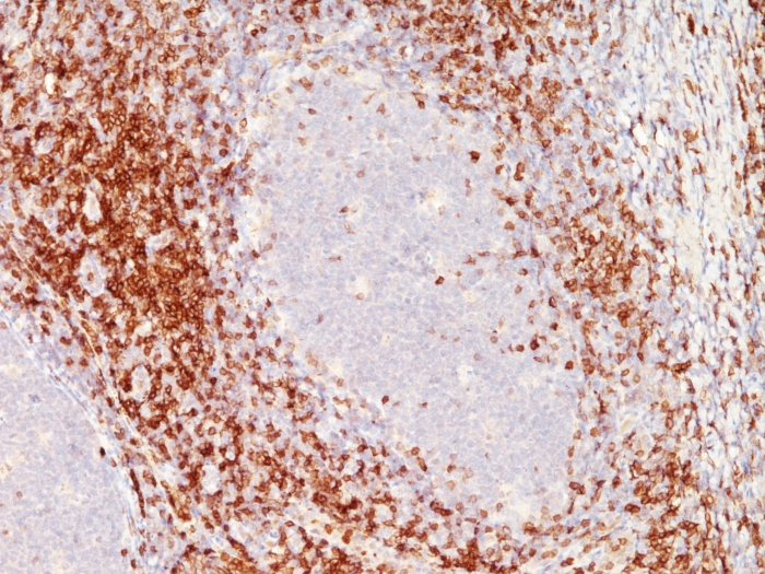 IHC-P analysis of tonsil tissue using GTX34537 CD6 antibody [SPM547].