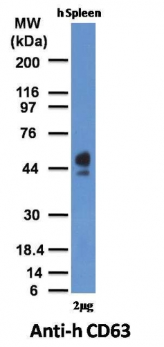 WB analysis of human spleen tissue lysate using GTX34540 CD63 antibody [MX-49.129.5].