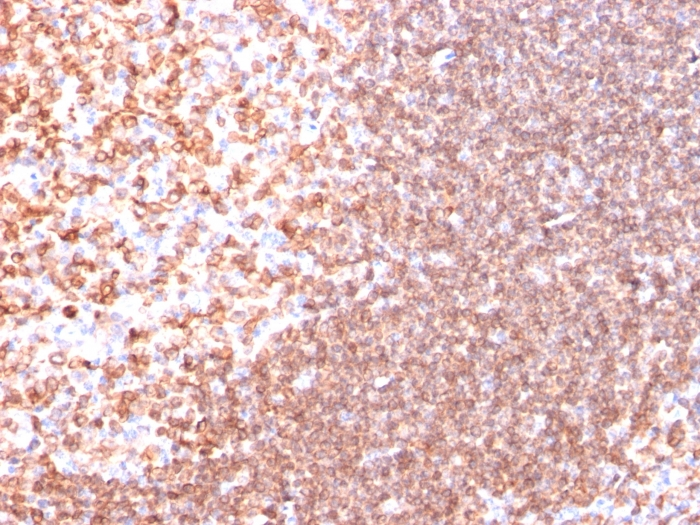IHC-P analysis of human tonsil tissue using GTX34552 CD74 antibody [SPM523].