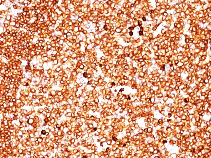 IHC-P analysis of human tonsil tissue using GTX34557 CD79a antibody [SPM549].