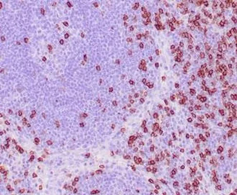 IHC-P analysis of human tonsil tissue using GTX34565 CD8 alpha antibody [C8/468].
