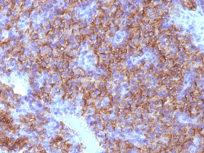 IHC-P analysis of human parathyroid tissue using GTX34599 Chromogranin A antibody [CHGA/798].