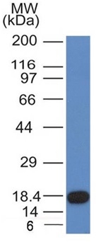 Western Blot of recombinant fragment of CD117 with CD117 Monoclonal Antibody (KIT/982).