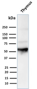 WB analysis of human thymus tissue lysate using GTX34623 Cytokeratin 10 antibody [LH2].