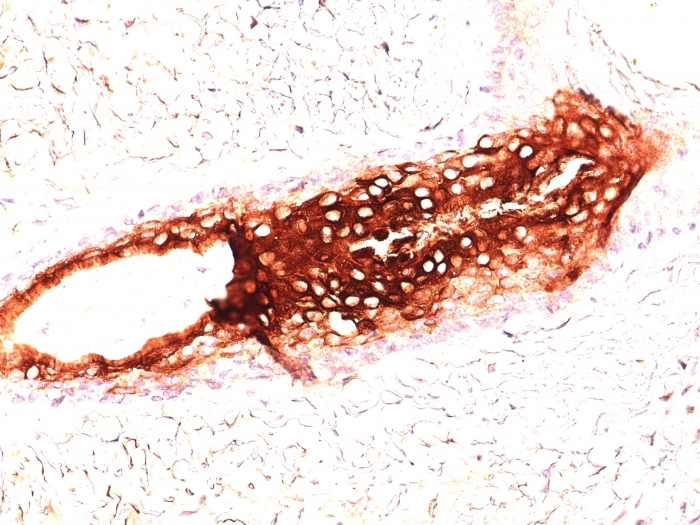 IHC-P analysis of human skin tissue using GTX34635 Cytokeratin 17 antibody [SPM560].