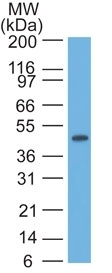 WB analysis of HeLa cell lysate using GTX34635 Cytokeratin 17 antibody [SPM560].