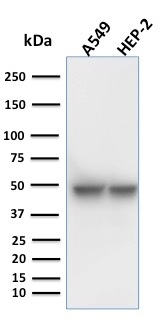 WB analysis of human A549 and HepG2 cell lysates using GTX34637 Cytokeratin 18 antibody [KRT18/1190].