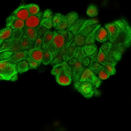 ICC/IF analysis of MeOH-fixed MCF-7 cells using GTX34649 Cytokeratin 19 antibody [SPM561]. Green : Primary antibody Red : nucleus