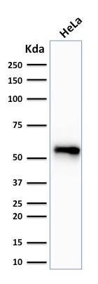 WB analysis of HeLa cell lysate using GTX34656 Cytokeratin 7 antibody [SPM270].