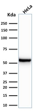 WB analysis of HeLa cell lysate using GTX34659 Cytokeratin 7 antibody [KRT7/760].