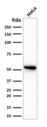 WB analysis of HeLa cell lysate using GTX34662 Cytokeratin 7 antibody [OV-TL12/30].